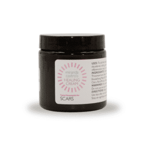 Miranda Castro's Healing Cream for Scars